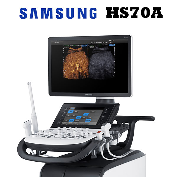 Samsung HS70A Ultrasound