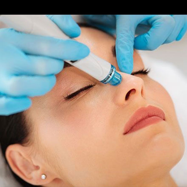 هایدرۆفه‌یشیه‌ڵ